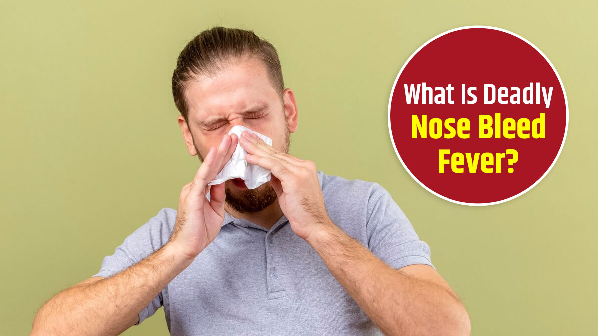 Nosebleed Fever Outbreak in Iraq: Check All Details Here